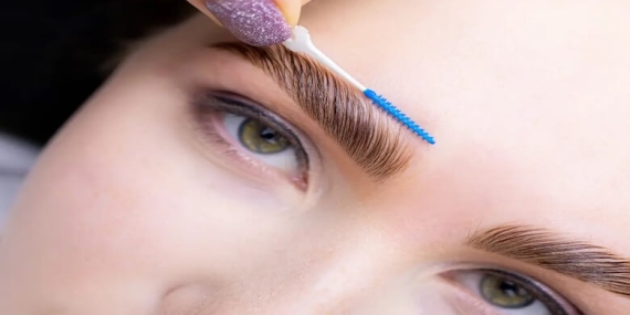 Kaş Laminasyonu Nedir?