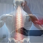 Bel ve Bacak Ağrısının Kalıcı Çözümü Var Mı?